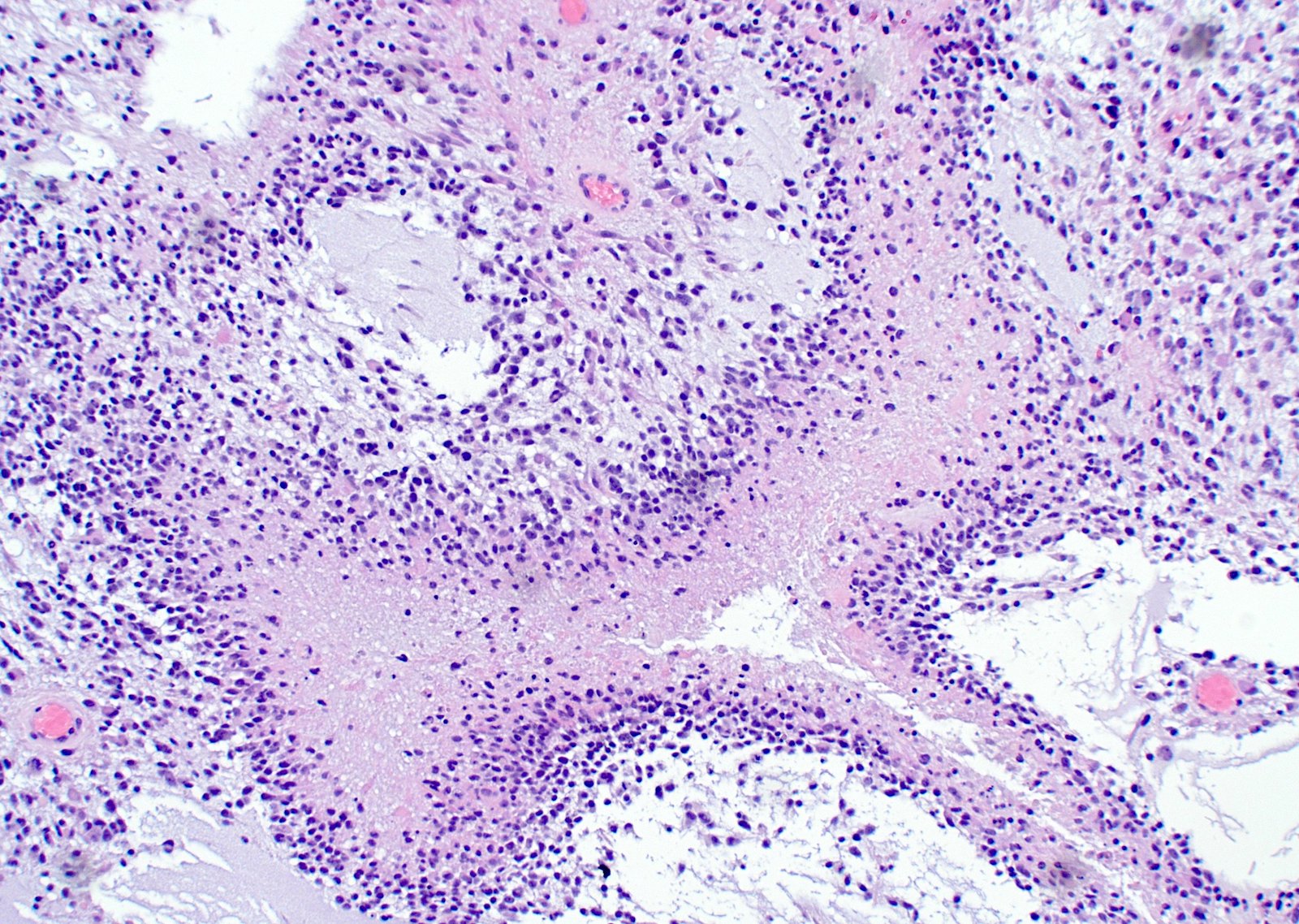 Cancer Treatment Histology - Advanced Diagnostic Technology